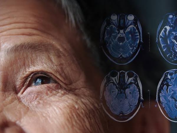 Parkinson’s Disease in India Has Its Own Genetic Story — And It’s Only Now Being&nbsp;Written